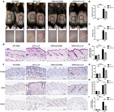 Corrigendum: OPN promotes pro-inflammatory cytokine expression via ERK/JNK pathway and M1 macrophage polarization in Rosacea